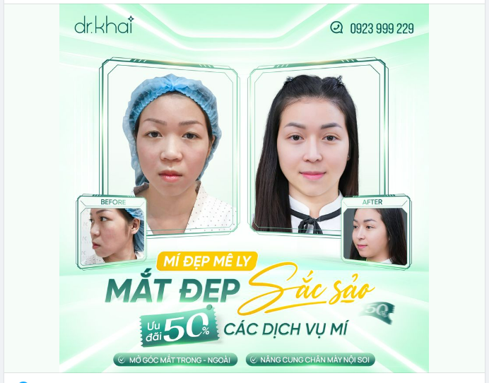MÍ ĐẸP MÊ LY - MẮT ĐẸP SẮC SẢO ƯU ĐÃI 50% CÁC DỊCH VỤ MÍ