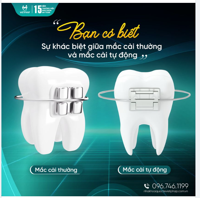 ĐIỀU LÀM NÊN TÍNH ƯU VIỆT CỦA MẮC CÀI TỰ ĐỘNG SO VỚI MẮC CÀI THƯỜNG