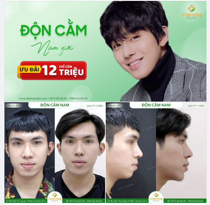 ĐỘN CẰM Ở NAM GIỚI - CHO GƯƠNG MẶT ĐẸP TRAI PHƠI PHỚI