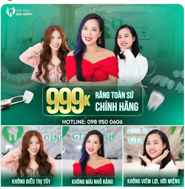 THÁNG 5 NÀY LÀM RĂNG THẨM MỸ KHÔNG PHẢI LO NGHĨ