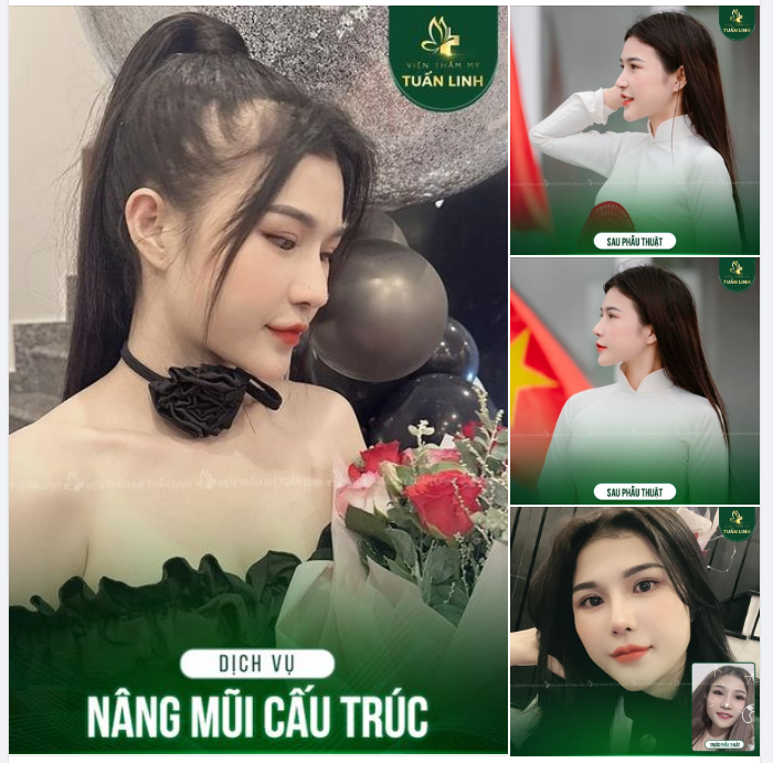 Chỉ cần chiếc mũi Cao Xinh gương mặt bạn đã sắc nét, nổi bật hơn rồi đó!!