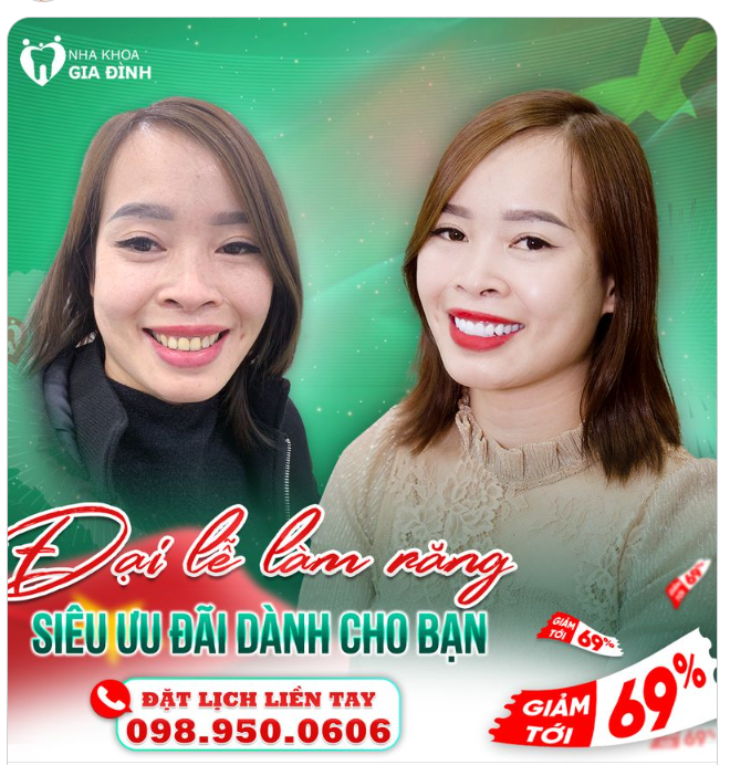 NHỚ NGÀY GIỖ TỔ - BÙNG NỔ NGAY THÔI!!!