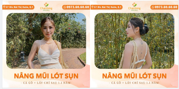 Thương em thì nói để em còn tính