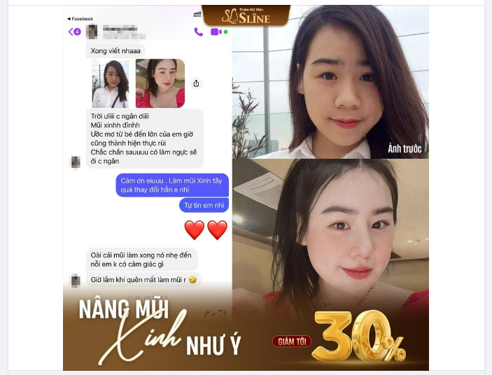 " TRỜI ƠI! MŨI XINH RỒI!