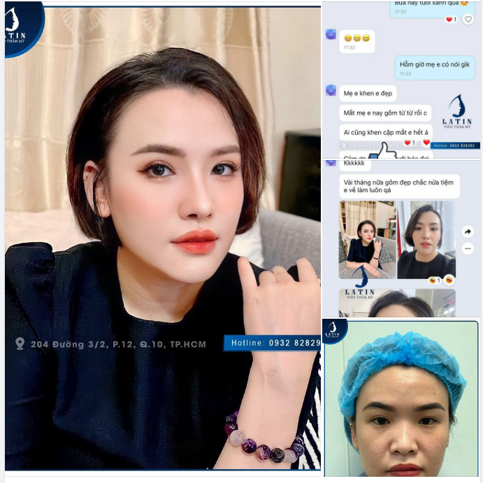 Việt kiều từ Mỹ về Việt Nam làm đẹp và cái kết
