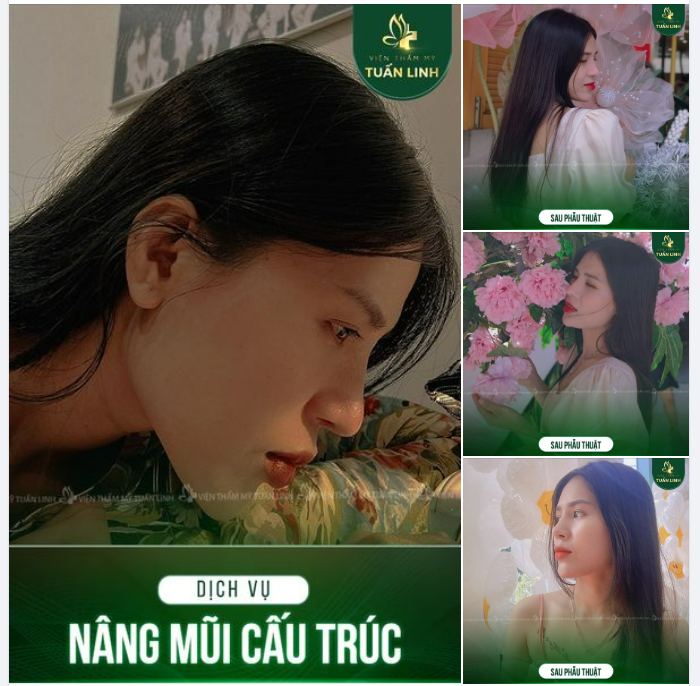 U mê với chiếc mũi cấu trúc đẹp siêu cấp tự nhiên này quá!!!