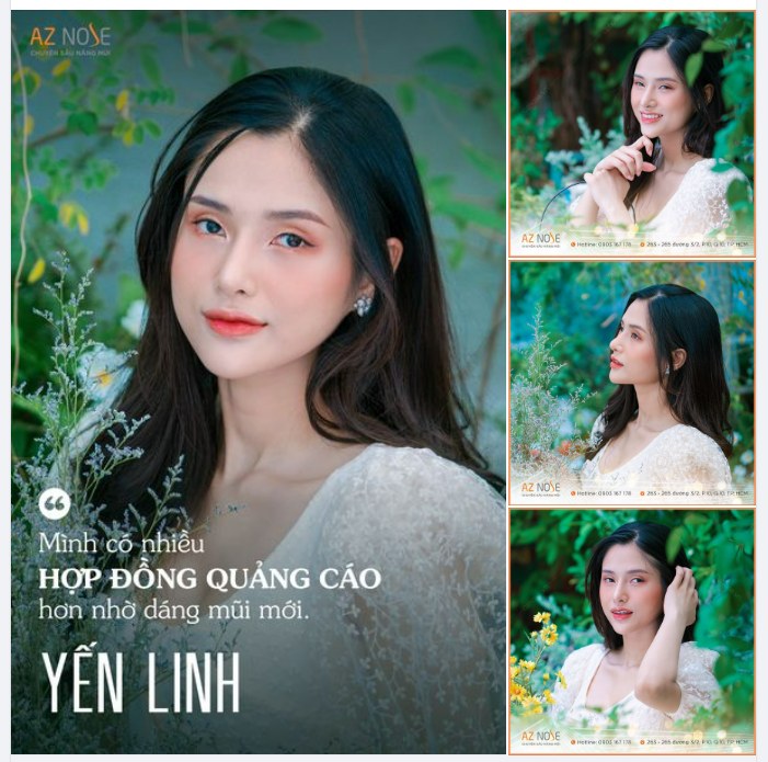 Tạm biệt dáng mũi mất cân đối vì tiêm filler, Nàng mẫu ảnh "phất lên" với diện mạo xinh đẹp