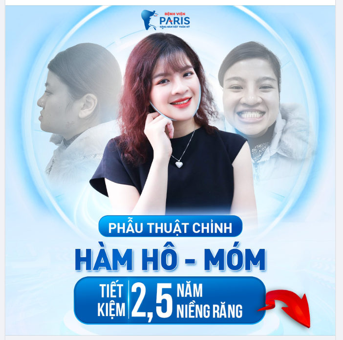Ít đau hơn, Xoá bỏ 100% hô, móm do xương