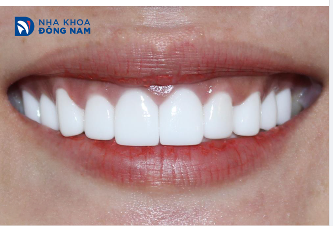 TỰ TIN VÀ TỰ TI CHỈ KHÁC NHAU Ở HÀM RĂNG