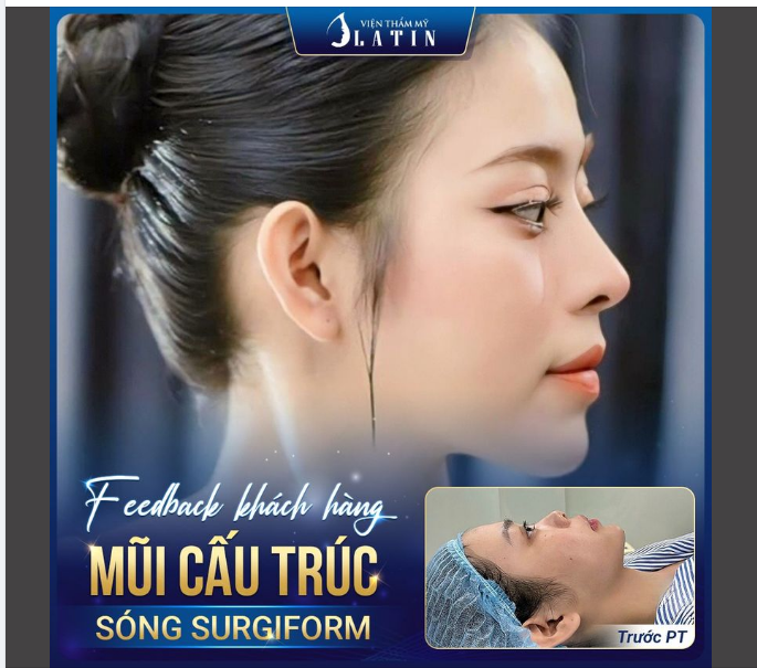 TỰ TIN VỚI DÁNG MŨI CAO THANH TÚ