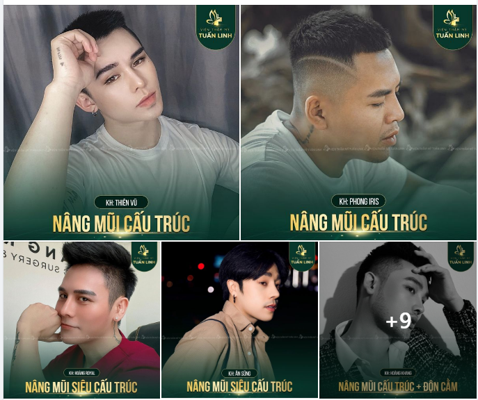 NÂNG MŨI NAM GIÁ CHỈ TỪ 9TR9 - SỞ HỮU DÁNG MŨI CHUẨN HOTBOY THEO CÁCH RIÊNG CỦA BẠN!!