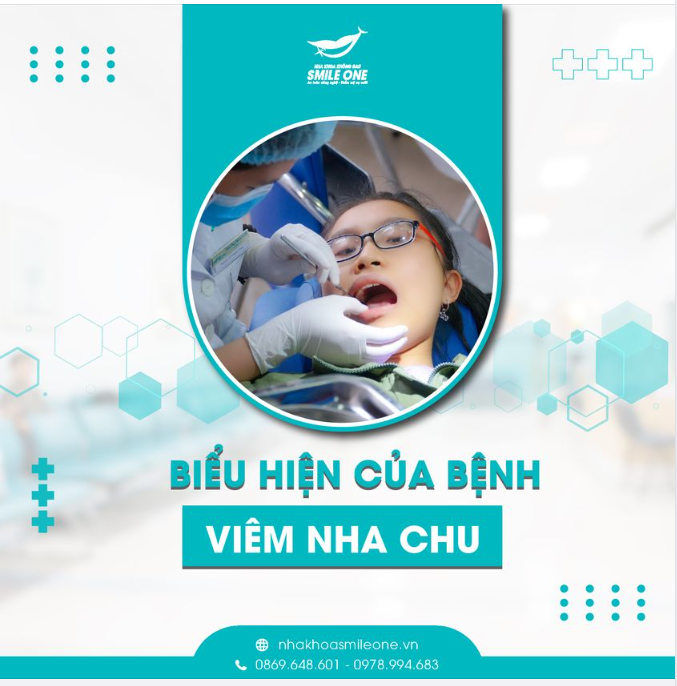 Biểu hiện viêm nha chu ở trẻ.