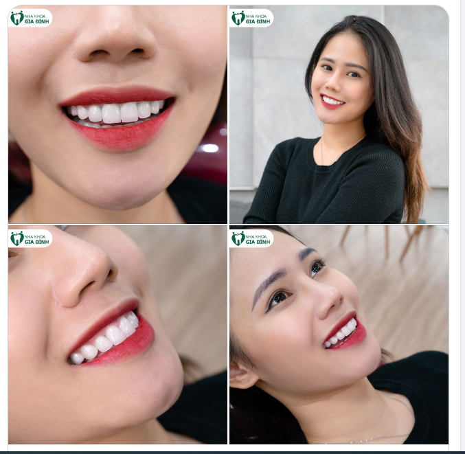 CHÌA KHÓA CỦA SỰ TỰ TIN CHÍNH LÀ NỞ MỘT NỤ CƯỜI ĐẸP