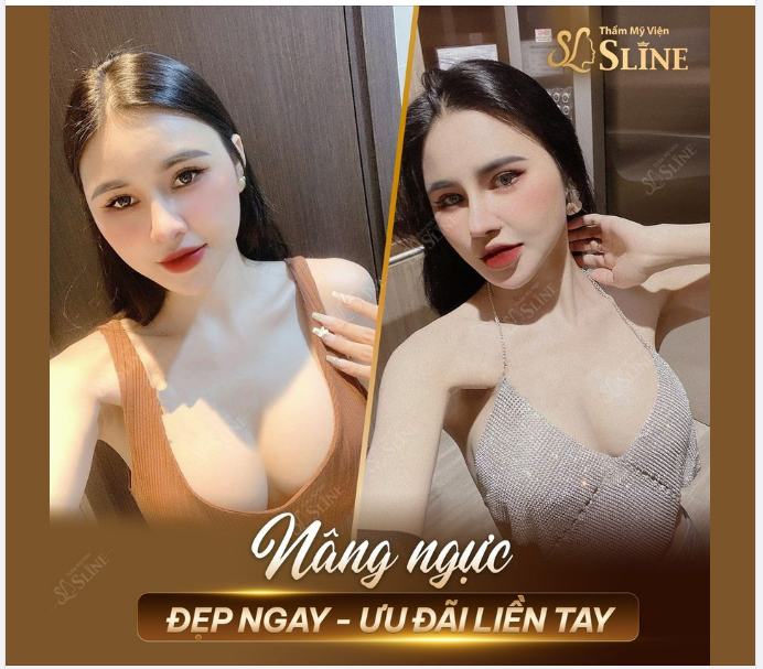 ĐÃ QUÁ SLINE ƠI !!!