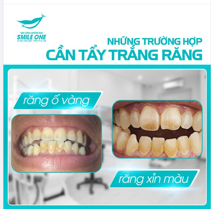 Nếu bạn không tự tin vì hàm răng ố vàng hay xỉn màu, hãy nghĩ ngay tới phương pháp tẩy trắng răng nhé!