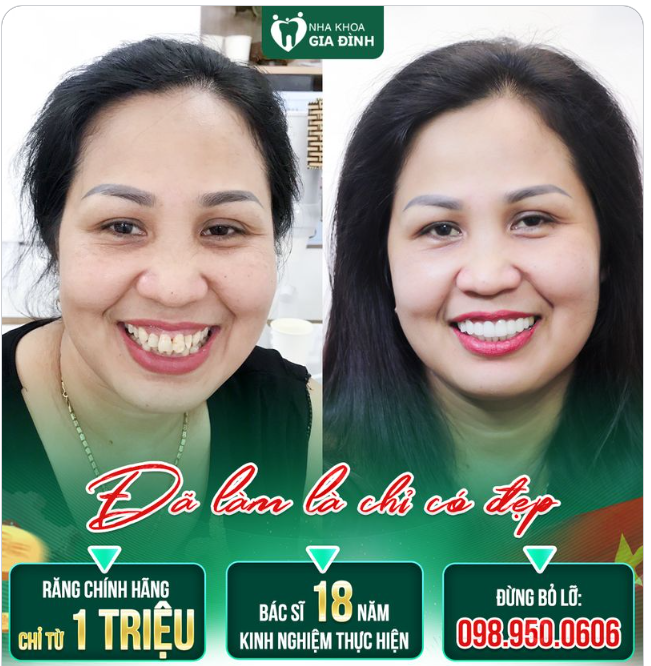 CHỈ 2 LẦN THÔI - BẠN CHỜ GÌ NỮA