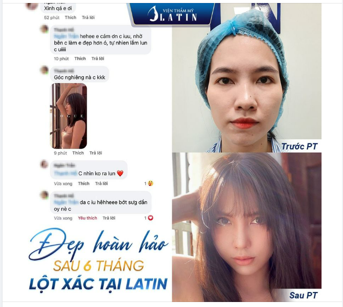 ĐẸP HOÀN HẢO SAU 6 THÁNG LỘT XÁC TẠI LATIN