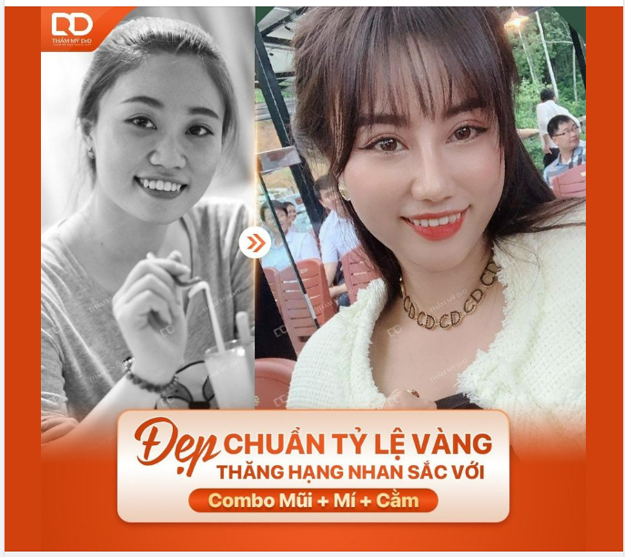 THĂNG HẠNG NHAN SẮC CỰC ĐỈNH VỚI COMBO MŨI MÍ CẰM