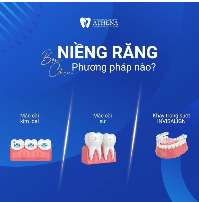 BẠN CHỌN GÌ CHO HÀNH TRÌNH NIỀNG RĂNG CỦA MÌNH