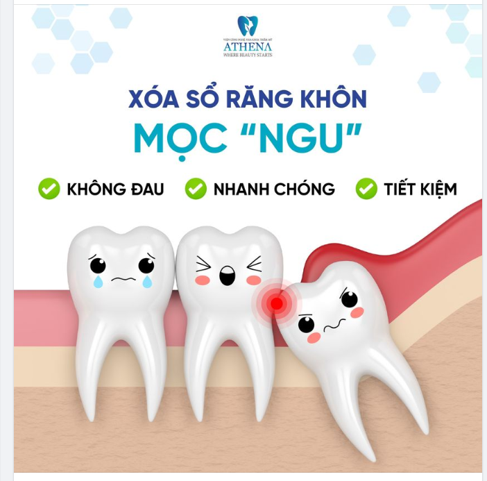 Xóa sổ răng khôn không đau - nhanh chóng - tiết kiệm tại ATHENA