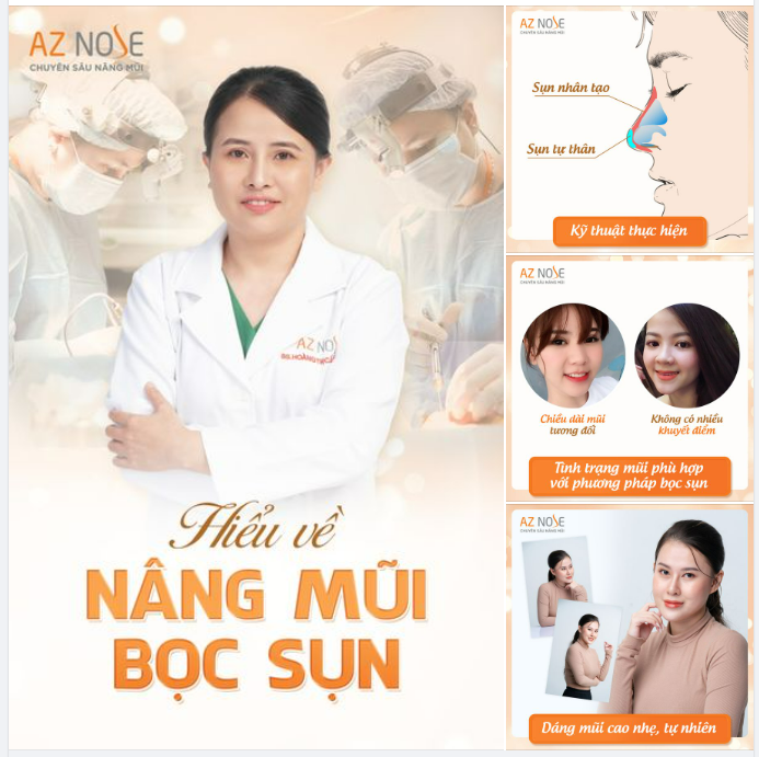 Nâng mũi bọc sụn và 3 điều có thể bạn chưa biết