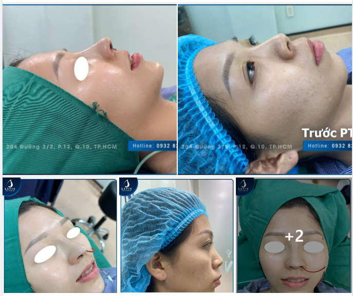 Làm đẹp đón Lễ cho khách hàng đến từ Đồng Nai