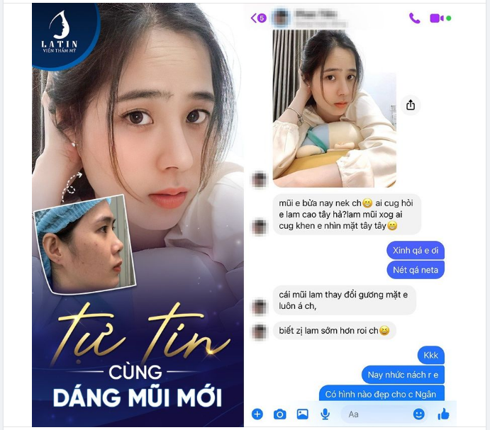 Nâng mũi có thực sự thay đổi cả khuôn mặt
