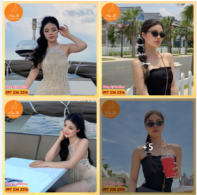 Mới đó mà đã gần 2 năm kể từ khi Hotgirl Hương Nguyễn chọn thẩm mỹ Mũi tại Hiệp Lợi !