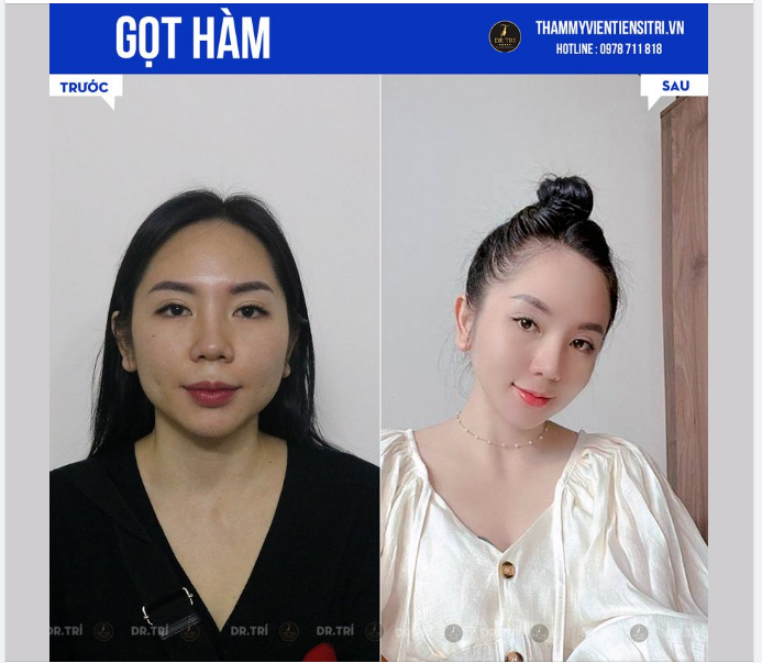 HÔ BIẾN HÀM VUÔNG GÓC CẠNH THÀNH THON GỌN