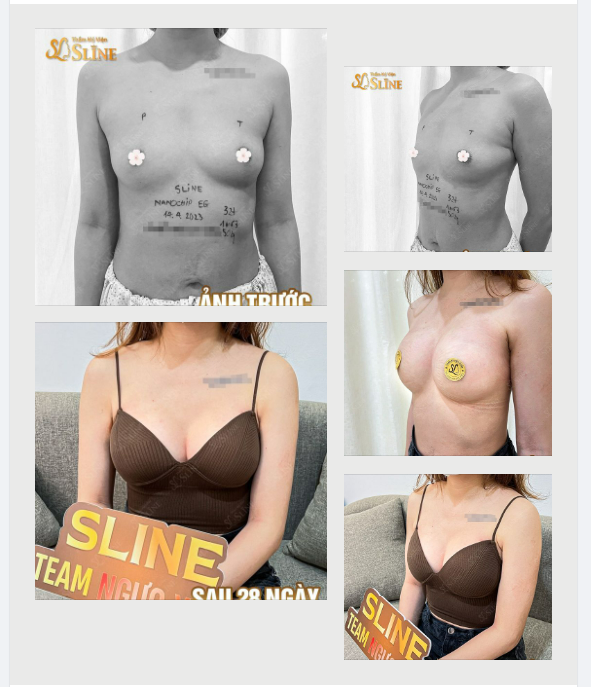 VÒNG 1 XINH XẮN - KHÔNG ĐĂNG THÌ TIẾC LẮM