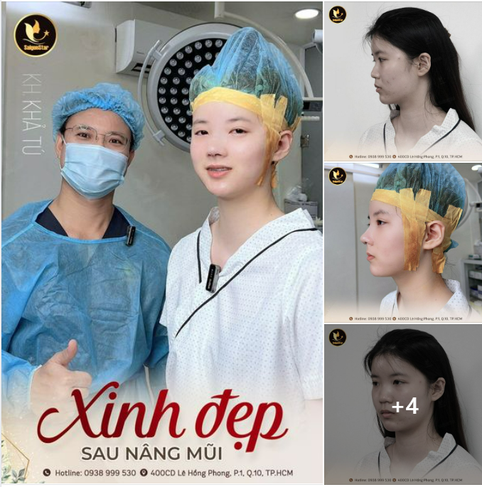 XINH ĐẸP SAU NÂNG MŨI DU HỌC SINH MỸ “THOÁT KIẾP” MŨI TẸT SAU 60 PHÚT