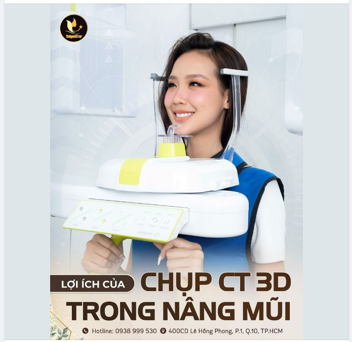 LỢI ÍCH CHỤP CT 3D TRONG QUÁ TRÌNH NÂNG MŨI