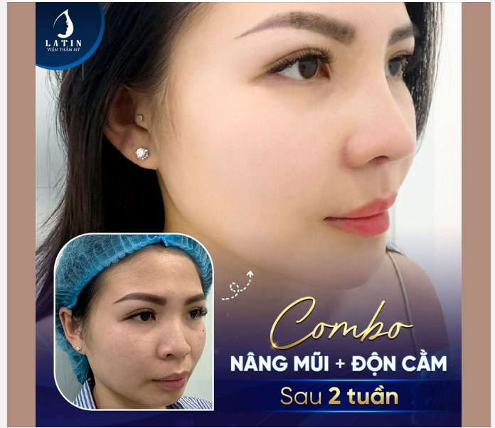 Thần thái thay đổi XUẤT SẮC