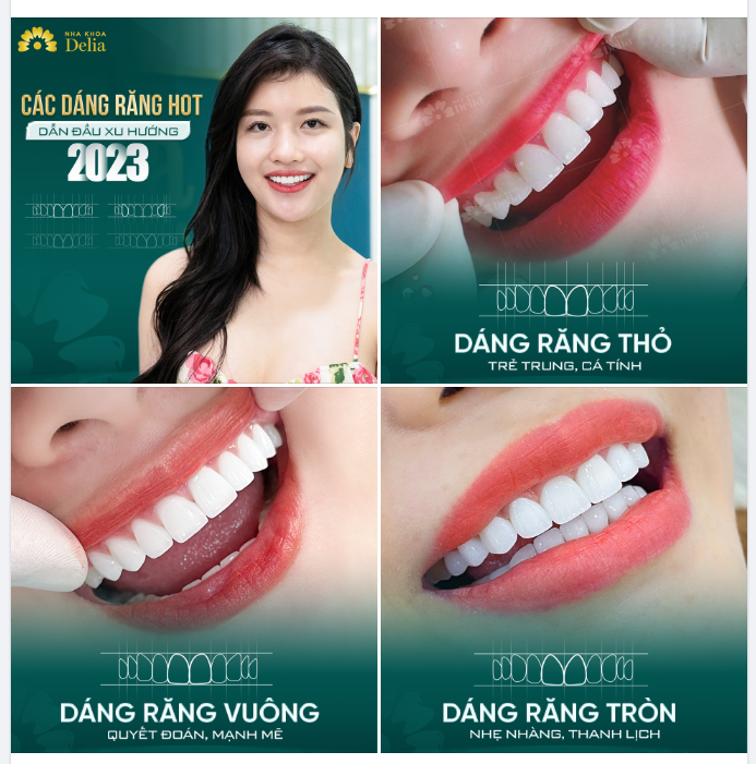 3 dáng răng sứ hot nhất năm 2023 tại nha khoa Delia
