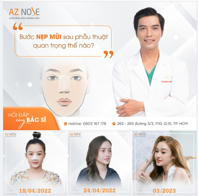Bước nẹp mũi sau phẫu thuật quan trọng thế nào?