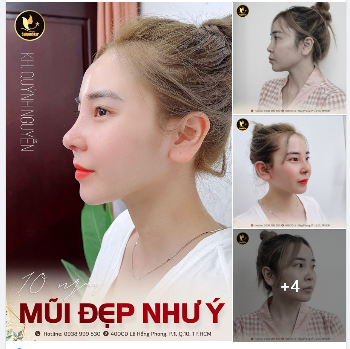 10 NGÀY MŨI ĐẸP NHƯ Ý