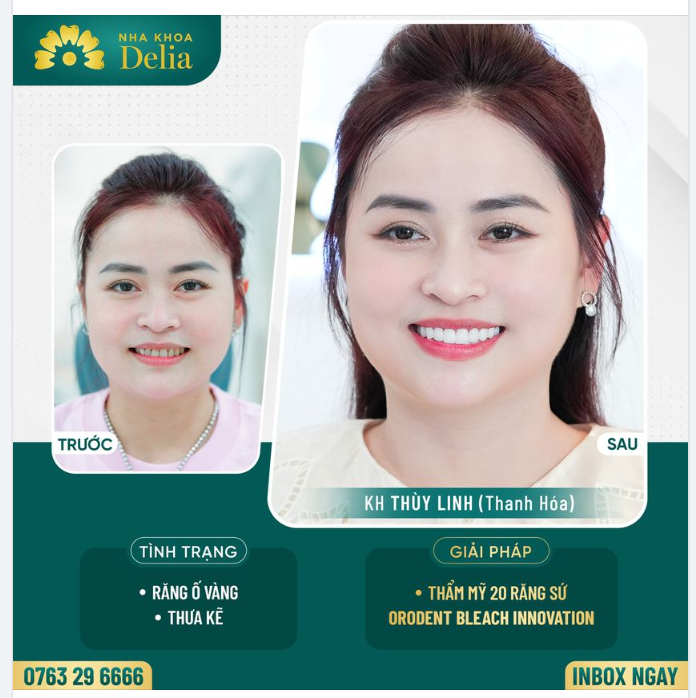48H - Kiến tạo nụ cười uy quyền cho chị gái VIP nhất Xứ Thanh
