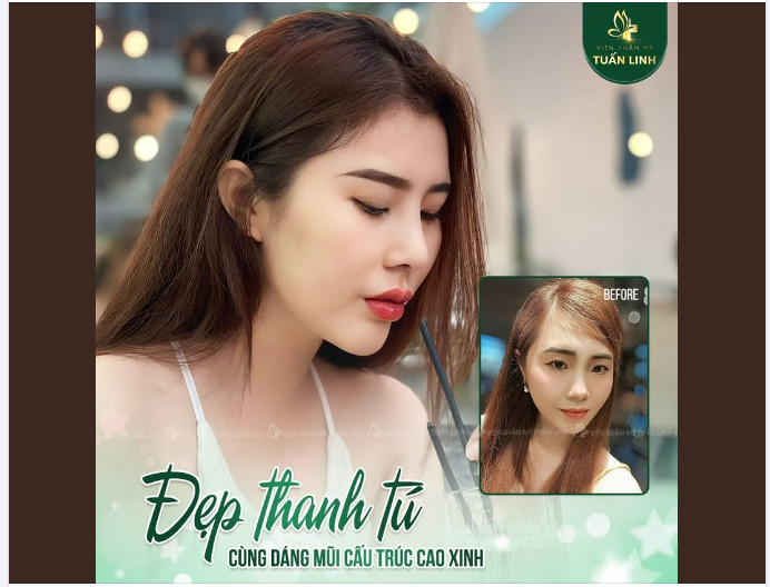 ĐẸP THANH TÚ CÙNG CHIẾC MŨI CAO XINH