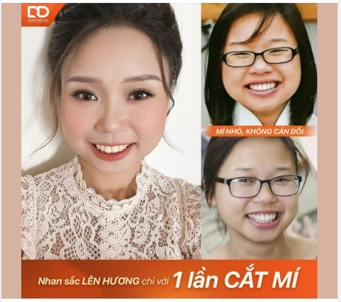 ĐẸP HƠN KHÔNG KHÓ, CHỈ CẦN BẠN CHỌN ĐÚNG NƠI VÀ SỬA ĐÚNG CHỖ