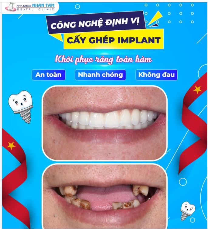 “Mừng ngày miền Nam Dân chủ Cộng hòa  Làm răng chắc khỏe để mà ăn ngon”