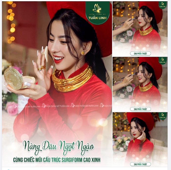XINH ĐẸP NGỌT NGÀO CÙNG CHIẾC MŨI CAO THANH TÚ