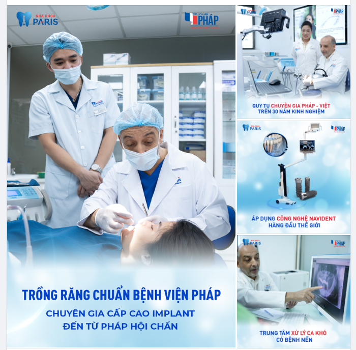TRỒNG RĂNG IMPLANT CHUẨN BỆNH VIỆN PHÁP - HƠN 15,000 KHÁCH HÀNG HÀI LÒNG