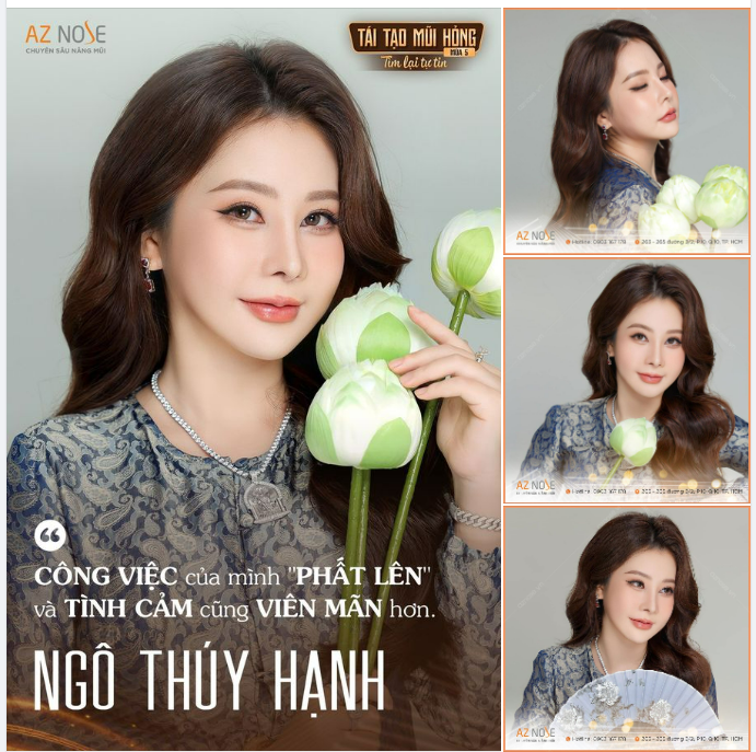 "Cô đồng Hà thành" hạnh phúc viên mãn sau 1 năm tái tạo mũi h.ỏng