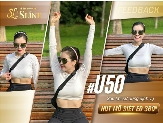 “CHỊ NGOẠI” U50 SAU KHI HÚT MỠ SIẾT EO 360