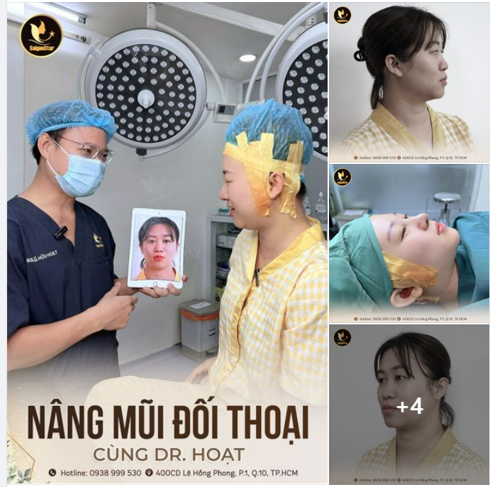 NÂNG MŨI ĐỐI THOẠI CÙNG DR.HOẠT