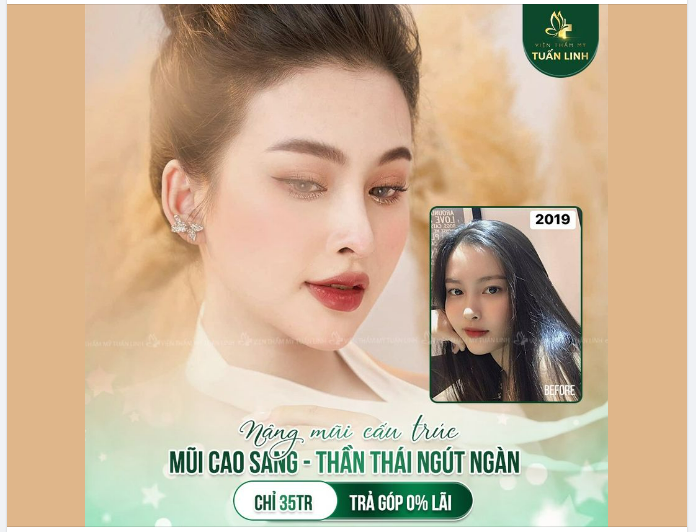 Bổ sung ngay một chút ''vitamin Xinh Đẹp'' từ khách hàng nhà Tuấn Linh nhé  Một chiếc nhan sắc rạng ngời cùng dáng mũi cao xinh.