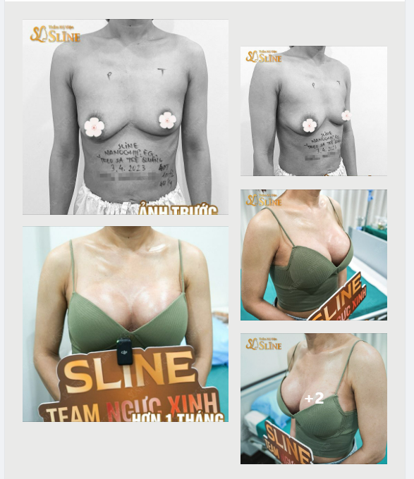 WOW…GÁI 1 CON TRÔNG MÒN CON MẮT LÀ ĐÂY!!