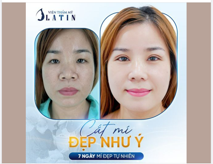 TRẺ HÓA ĐÔI MẮT - NGƯỢC DÒNG THỜI GIAN