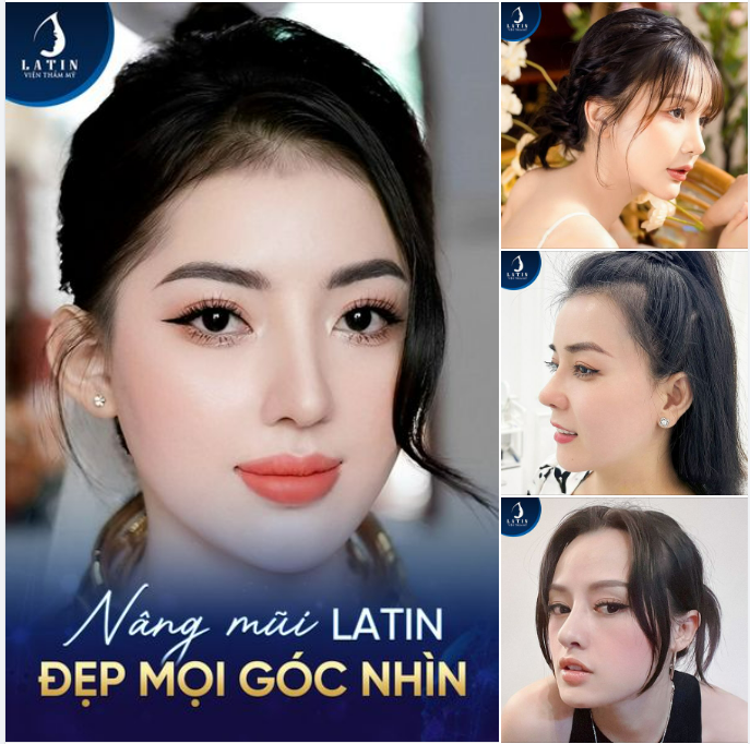 NÂNG MŨI LATIN - ĐẸP MỌI GÓC NHÌN