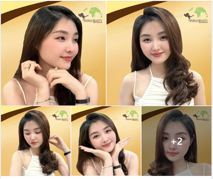Lên form dáng mũi vô cùng tự nhiên cho quý cô bằng giải pháp nâng mũi cấu trúc sụn tự thân kết hợp thanh Surgiform